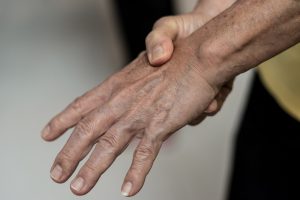 Formigamento nas mãos e pés: o que é e quando se preocupar?